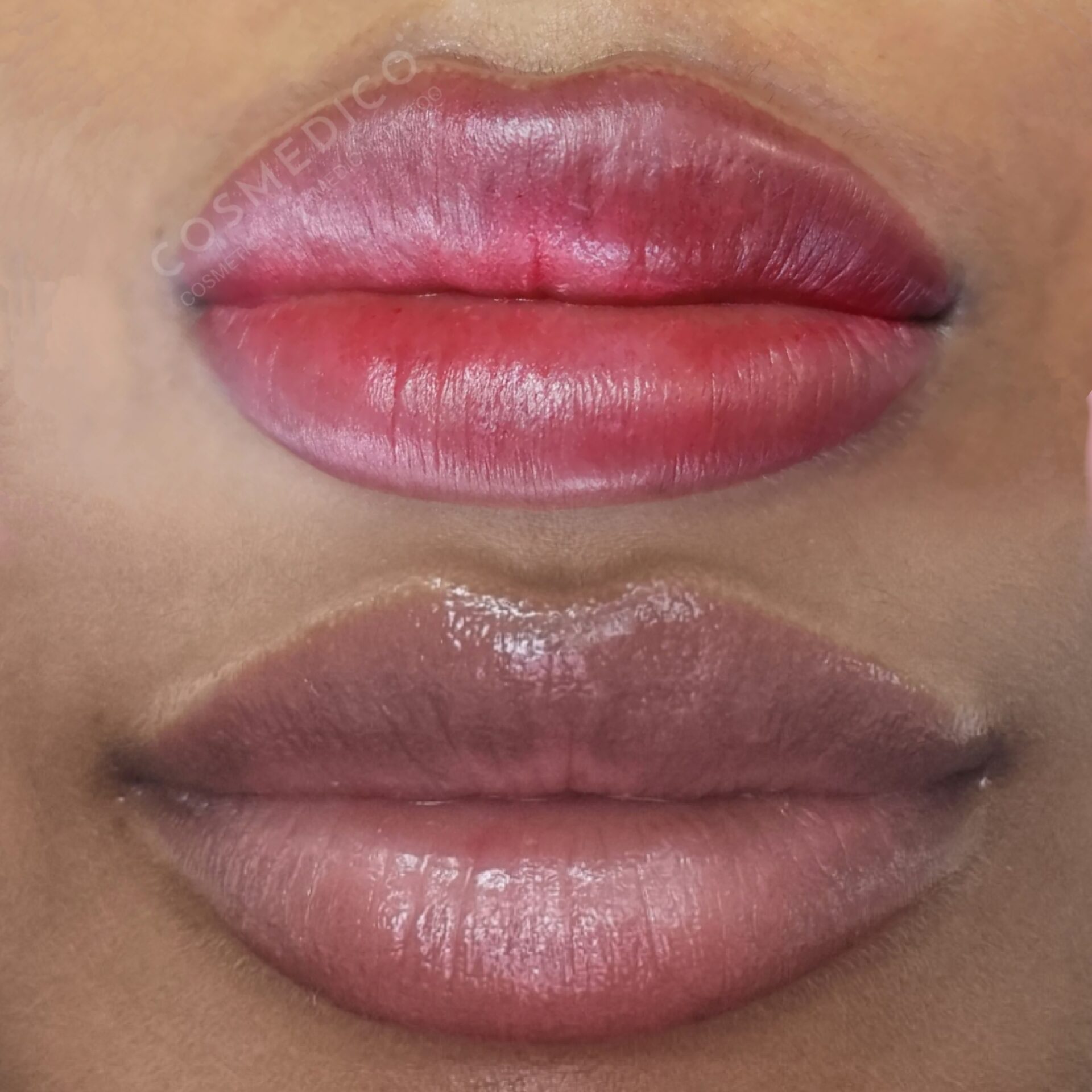 Permanent Lip Colour Tattoo Artist in Durban and KZN - Cosmedico is a professional Cosmetic Artistry.