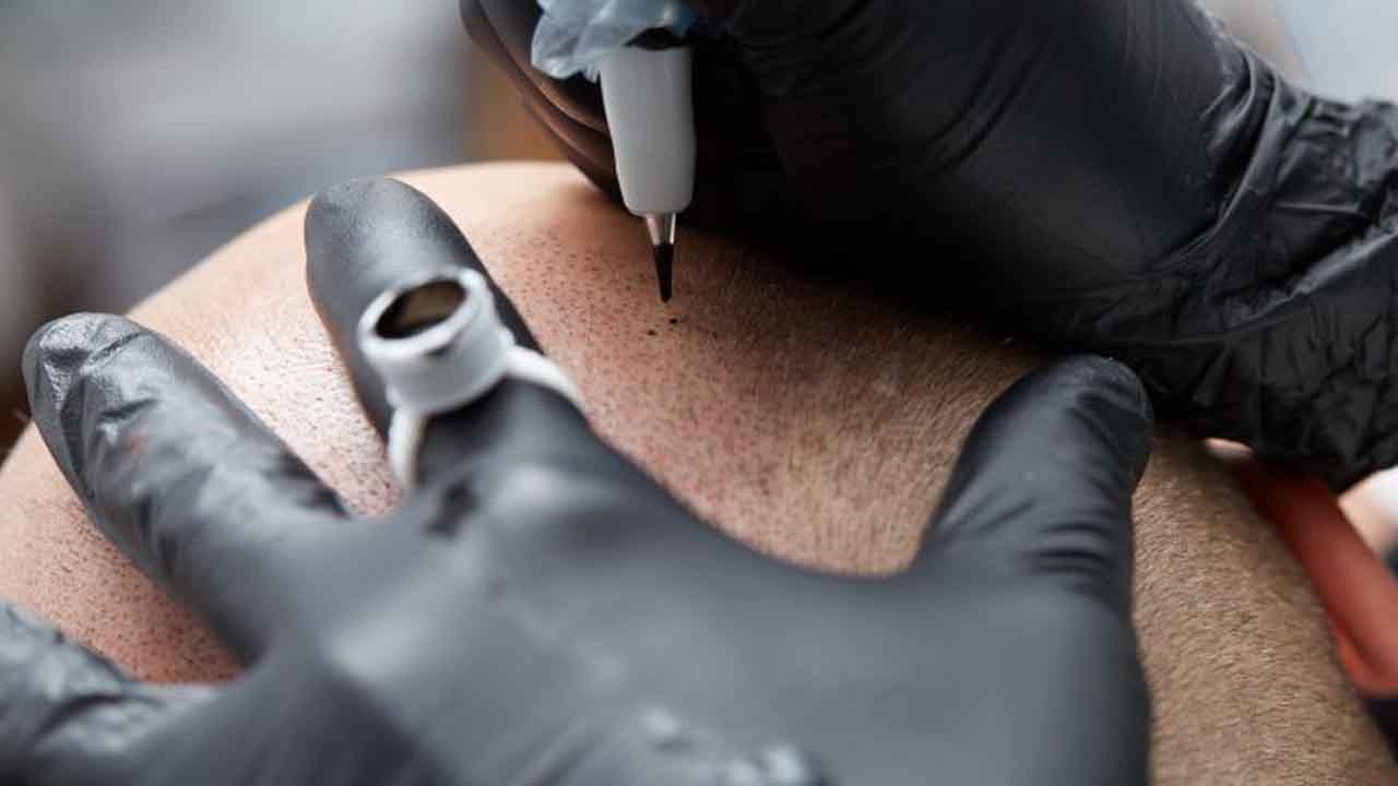 scalp micropigmentation specialists in durban and KZN. Professional Cosmestic Tattoo Artist